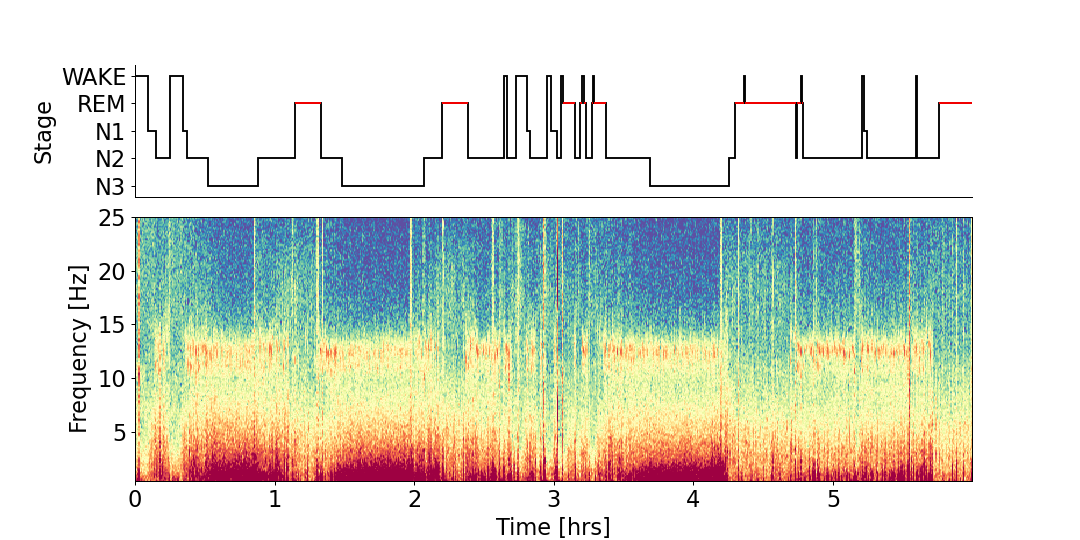 ../_images/yasa-plot_spectrogram-2.png