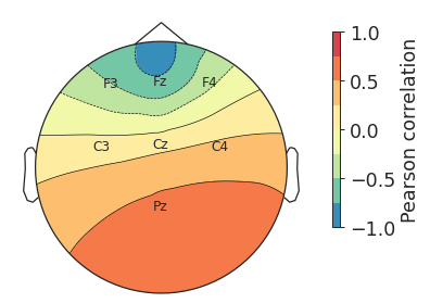 ../_images/yasa-topoplot-2.png